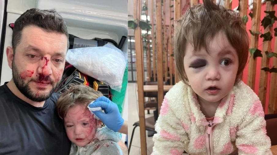 Yalova’da dehşet; Baba ve kızı darp edildi!