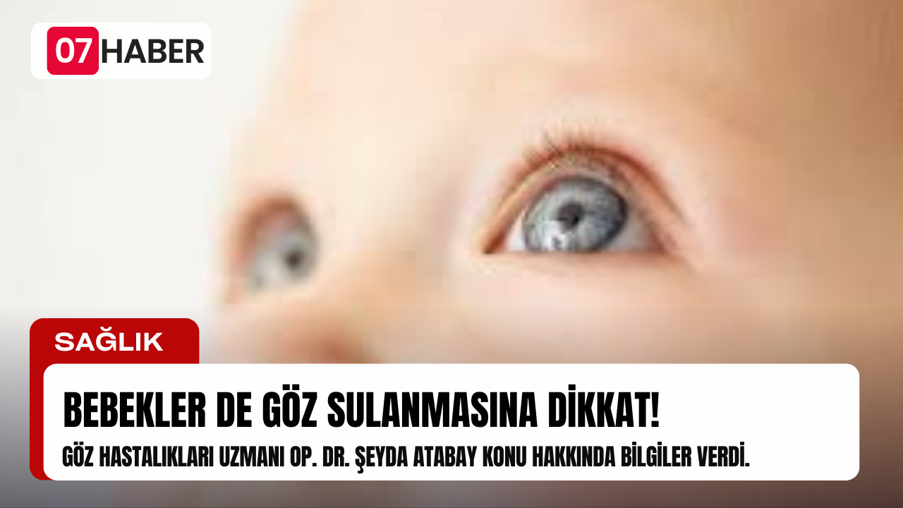 BEBEKLER DE GÖZ SULANMASINA DİKKAT!