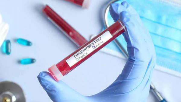 Britanya'da 1 dolarlık Koronavirüs testi geliştirildi
