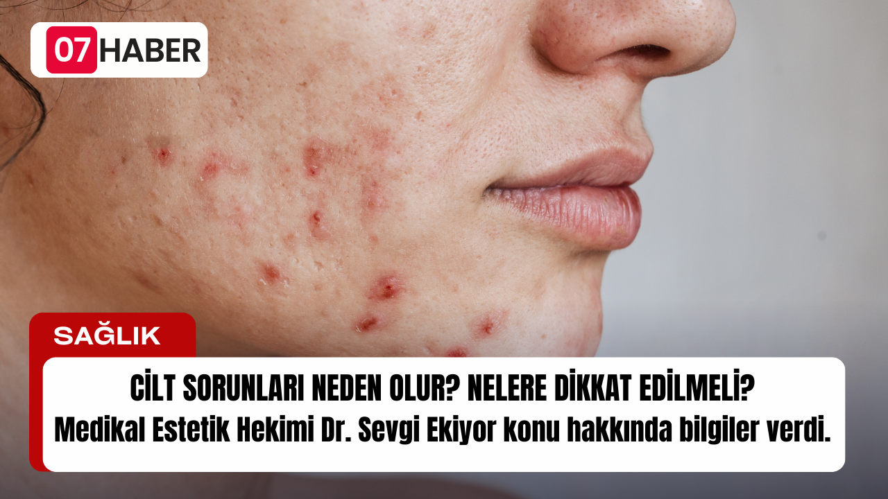 CİLT SORUNLARI NEDEN OLUR? NELERE DİKKAT EDİLMELİ?