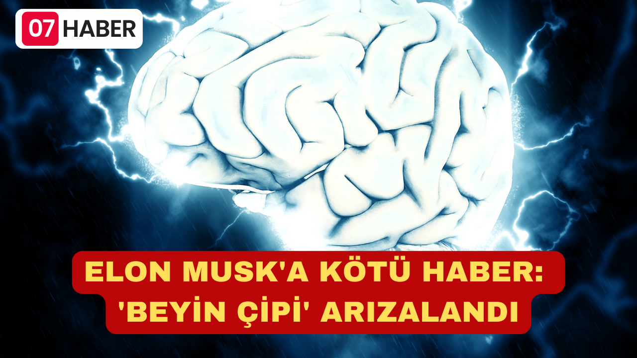 ELON MUSK'A KÖTÜ HABER: 'BEYİN ÇİPİ' ARIZALANDI