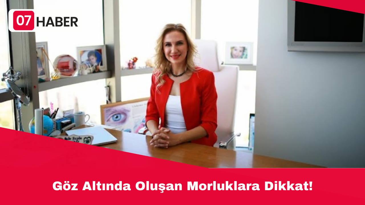 Göz Altında Oluşan Morluklara Dikkat!