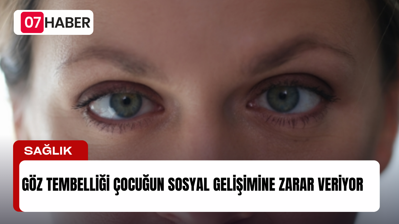 GÖZ TEMBELLİĞİ ÇOCUĞUN SOSYAL GELİŞİMİNE ZARAR VERİYOR