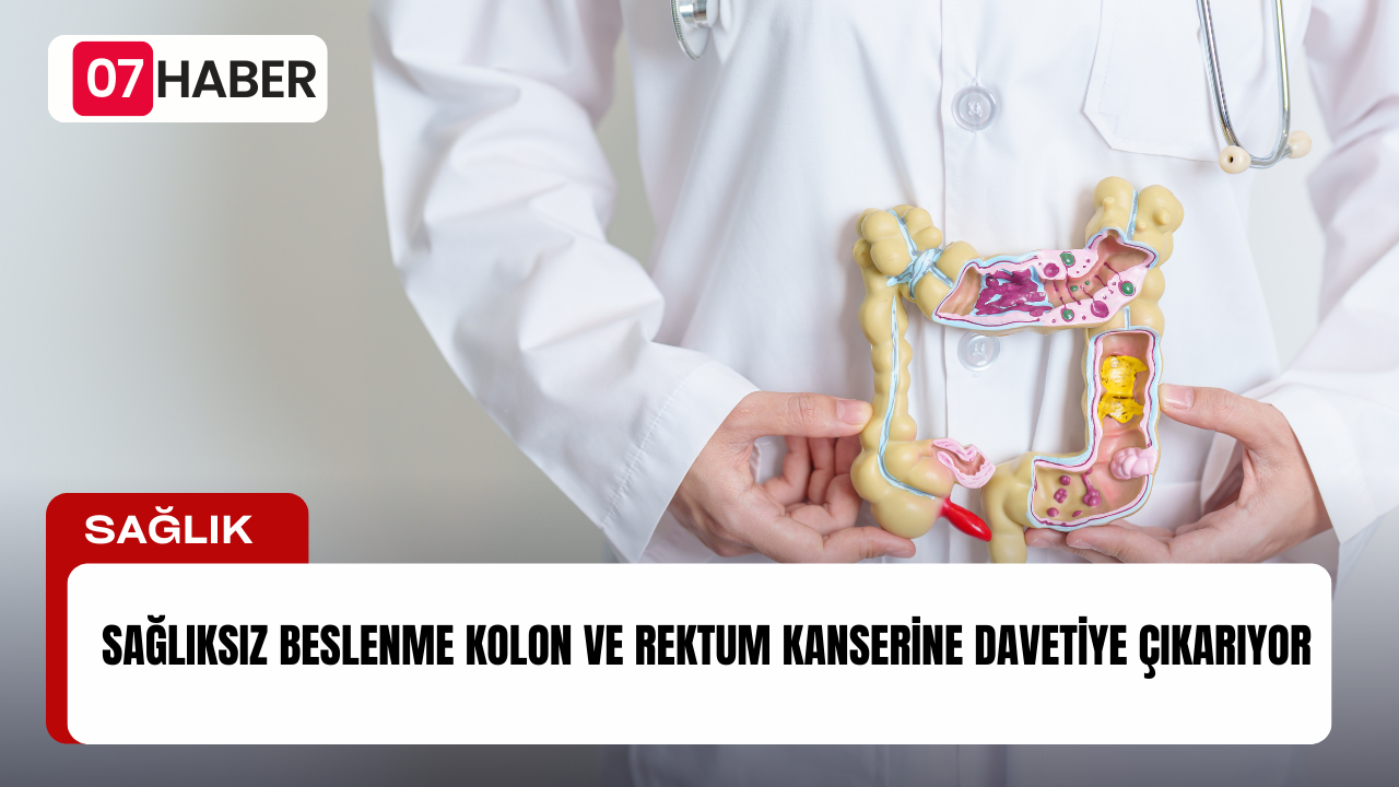 SAĞLIKSIZ BESLENME KOLON VE REKTUM KANSERİNE DAVETİYE ÇIKARIYOR