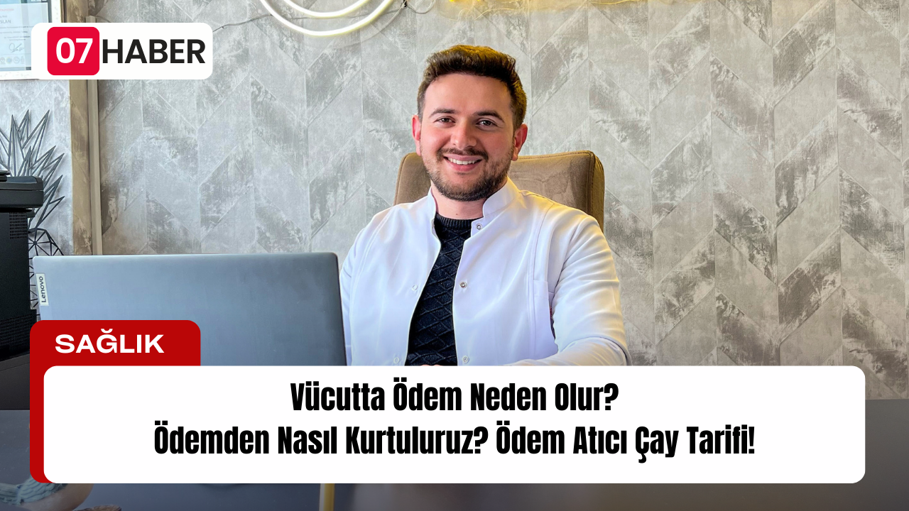 Vücutta Ödem Neden Olur? Ödemden Nasıl Kurtuluruz? Ödem Atıcı Çay Tarifi!