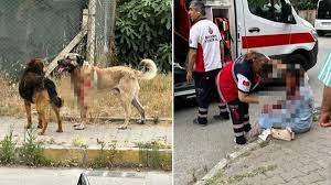Yoldan Geçen Kadına Bekçi Köpeği Saldırdı